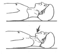 儿童头前倾矫正,头前倾矫正训练动作