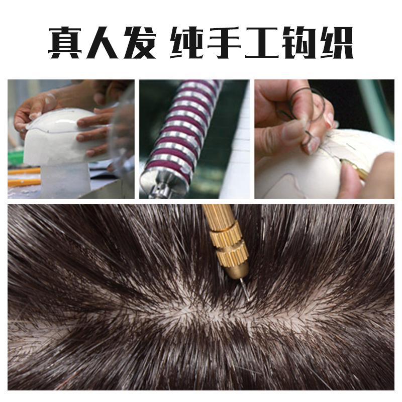 织发补发山东,织发补发的发展