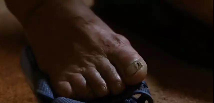 胆小勿入!揭开“尸毒”的神秘面纱