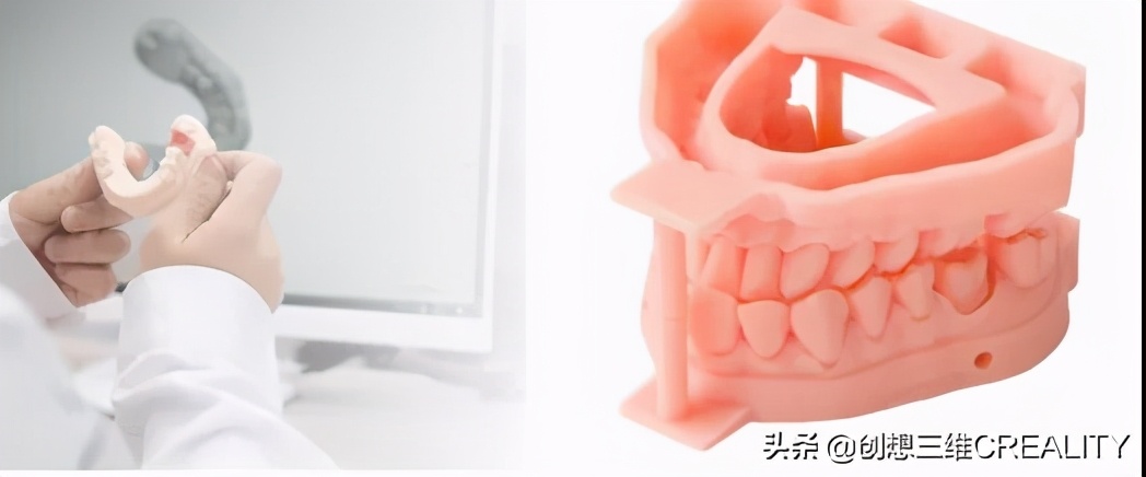 光固化3d打印机分类,光固化3d打印机比fdm好吗