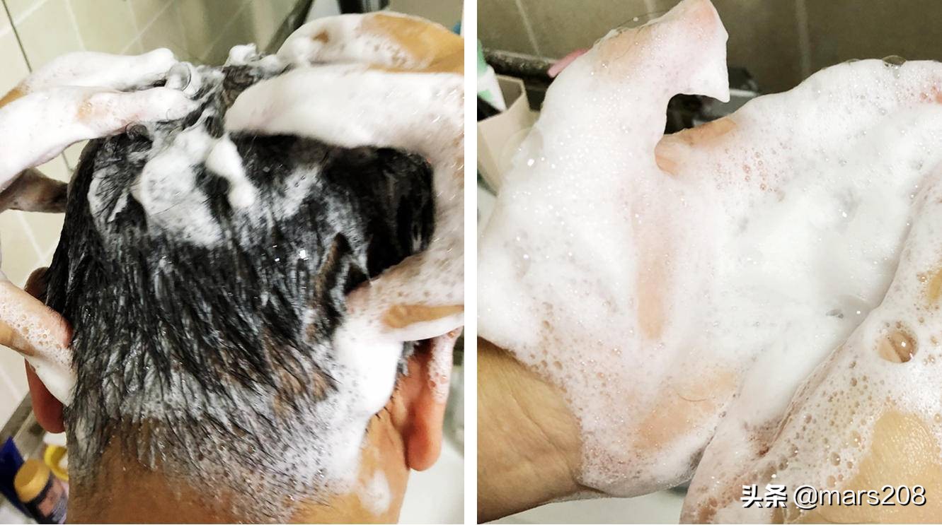 保护毛囊发际线的神器,防脱发保护发际线