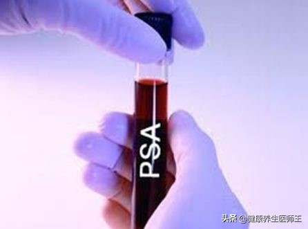 肿瘤标志物筛查多少钱,肺肿瘤标志物有哪几项