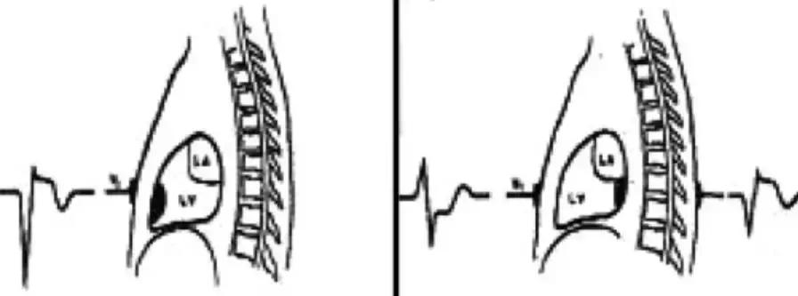 心电图和心脏彩超以哪个为准,心电图和心脏超声是一样吗