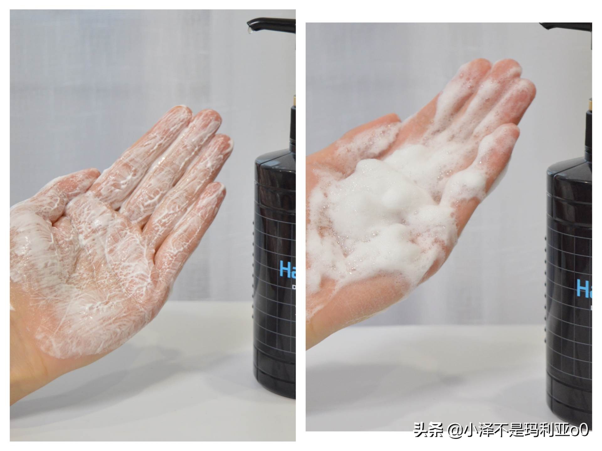 额头秃发际线后移适合什么洗发水,拯救发际线的洗发水