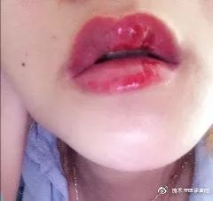内行人为什么不建议漂唇,作为一名医生一直被人质疑