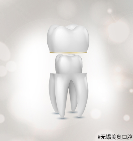 烤瓷牙和全瓷牙应该怎么选,全瓷牙和烤瓷牙会有口臭吗