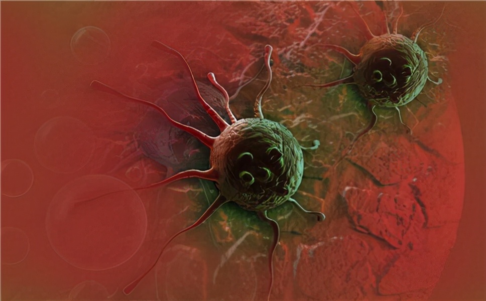 锥切病理1mm浸润癌会不会转移很快,浸润癌能彻底治好么