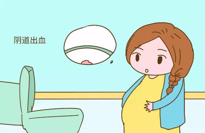 足月待产注意事项,孕妇足月是37周第一天开始吗