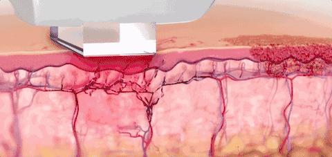 你「累丑」了吗？这份自救指南请收好，毕竟丑不算“工伤”