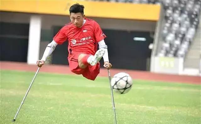 单腿截肢后又双腿截肢,单大腿截肢能游泳吗