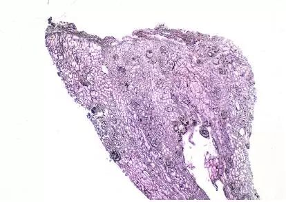 肾毒性的药物排名,肾毒性食物有哪些