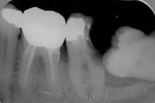 美国警察跪杀案宣判,美国警察跪杀案例