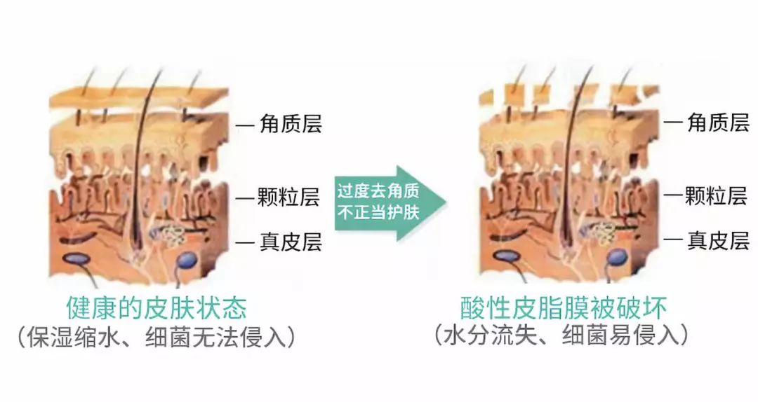 冬天面部角质层薄起皮泛红,换季敏感皮肤泛红脱皮怎么办
