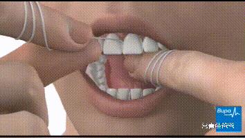 孩子有了龋齿刷牙还有用吗,用牙线清理牙缝很臭是蛀牙吗