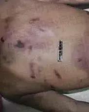 法医讲述尸体分析,法医在尸体中找到真相