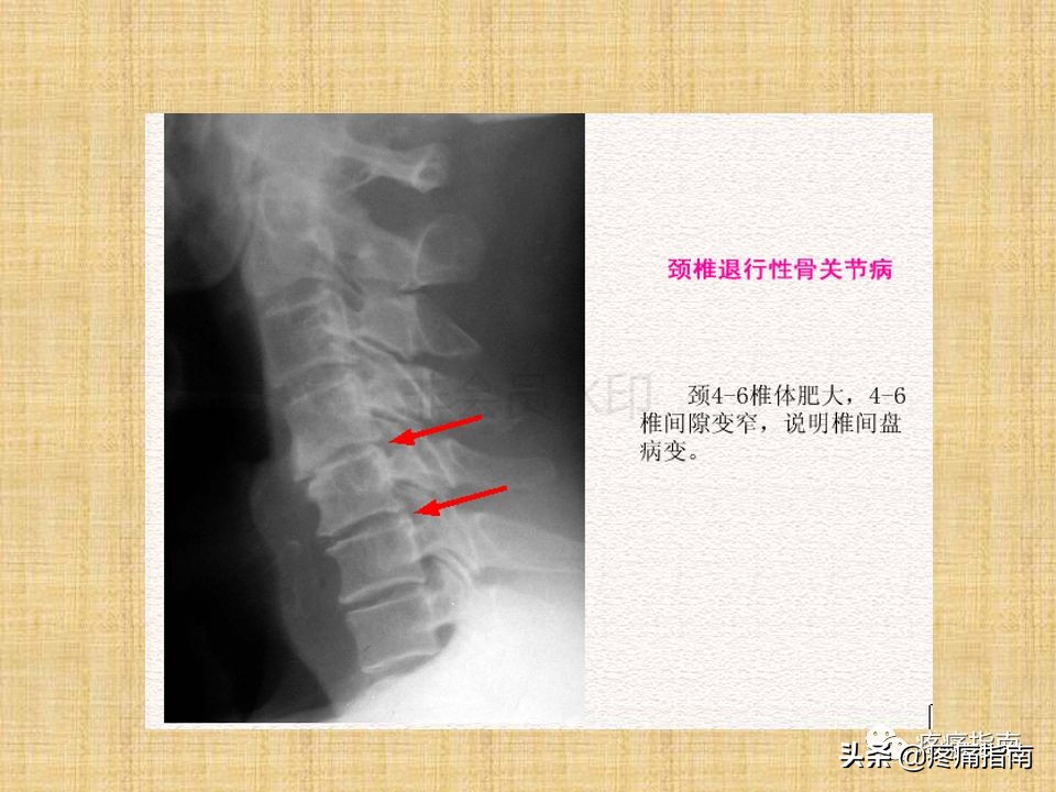 中医针灸推拿学入门,真正厉害的中医推拿