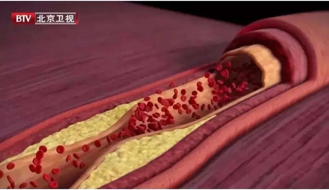 运动以后脸青口唇白,运动完脸红和脸白的人谁更健康