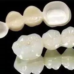 琚墮鍖诲拷鎮犲仛浜嗗叏鐡风墮瀵艰嚧鍢村嚫,鎻鐗欏尰璇寸殑鍏ㄧ摲鐗欏埌搴曟湁澶氬ソ