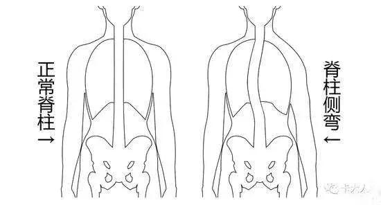 纠正不良姿势,不良体态矫正最佳方法