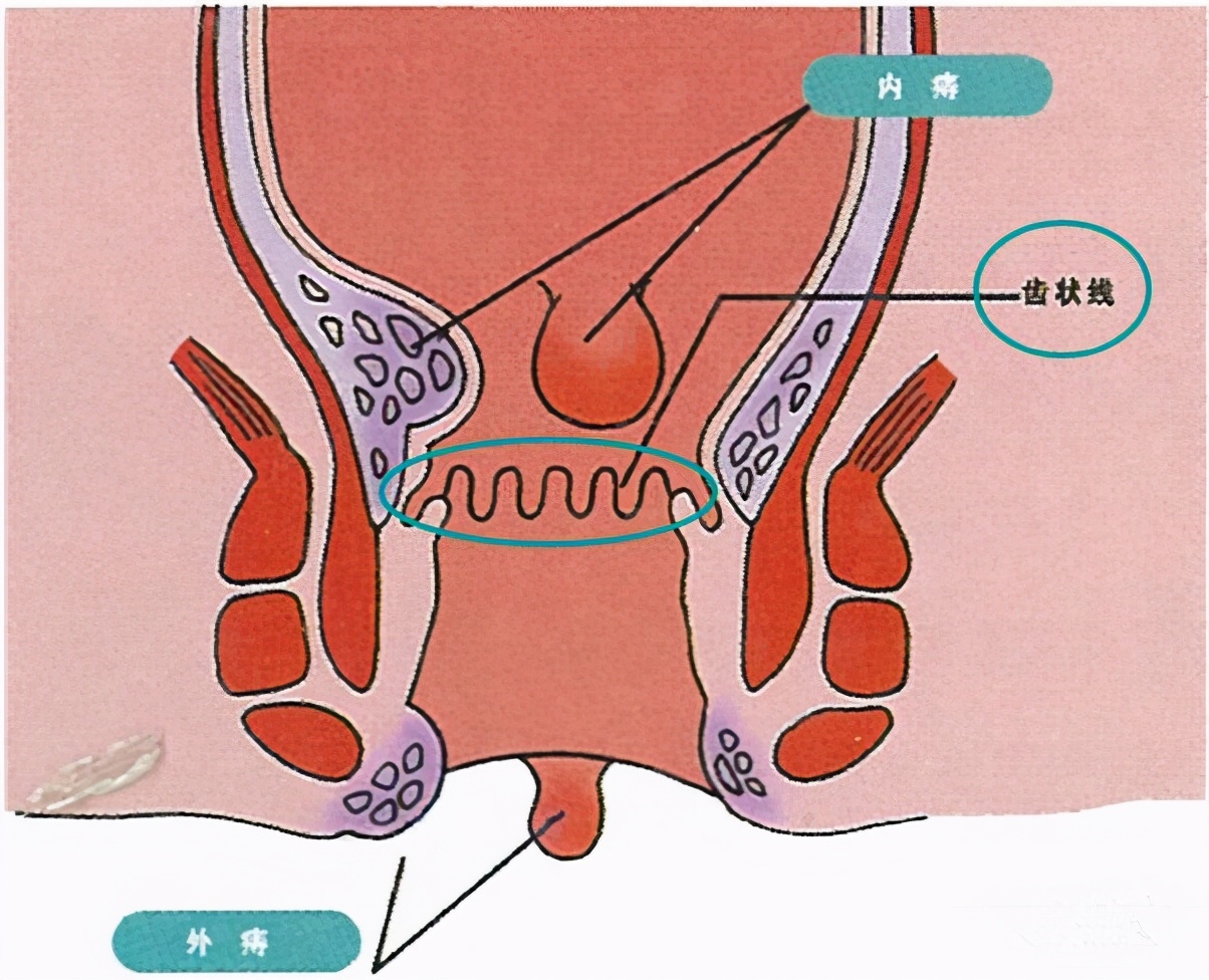 肛肠科那些事儿：杨大夫带你进入神秘的后门儿