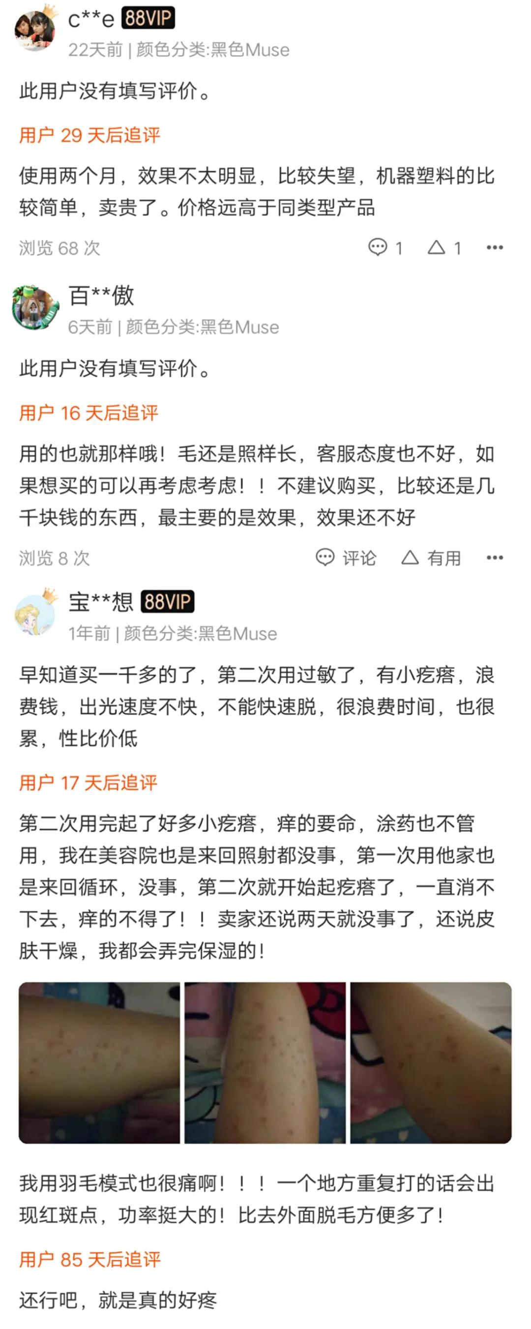 动辄几千元的smoothskin网红脱毛仪安全性存疑，经营主体屡次受罚