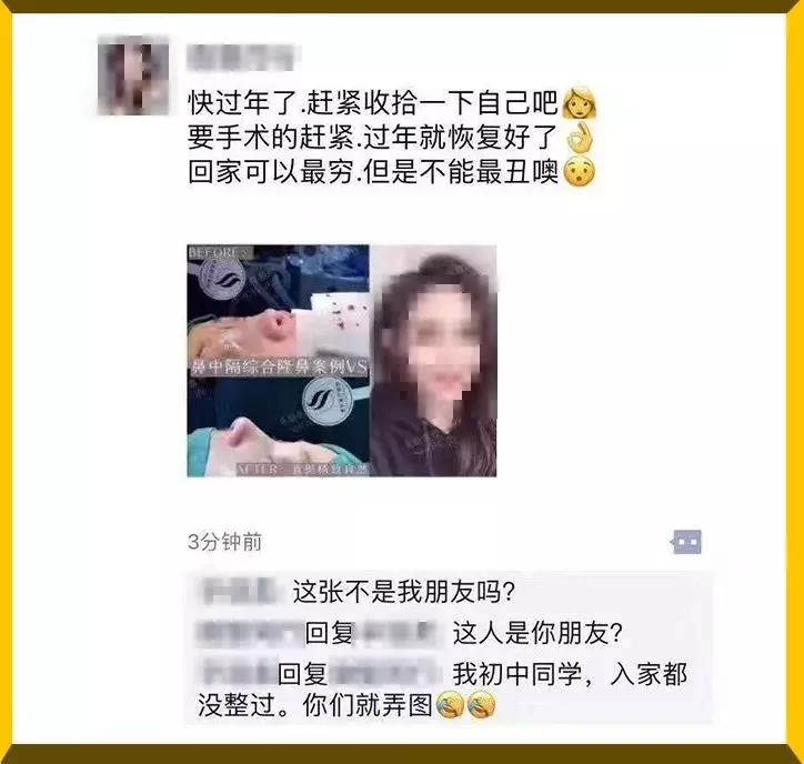 花了26万做整容手术,24岁女子花21万整容