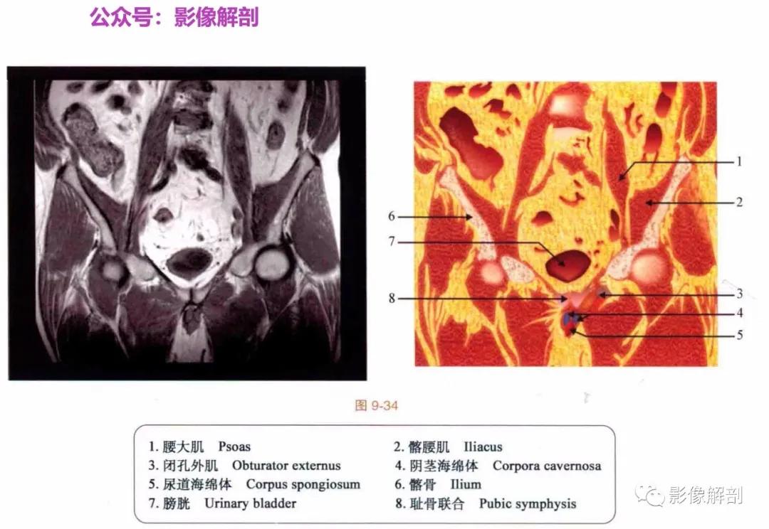 女性盆腔矢状位断层解剖,男性盆腔磁共振断层图谱