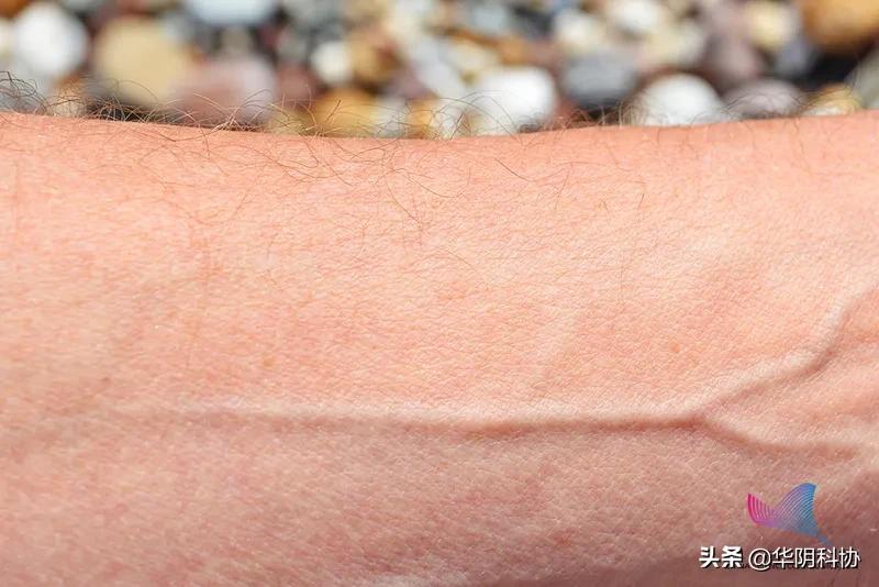 青筋暴起是怎么一回事,青筋暴起是怎么回事呢