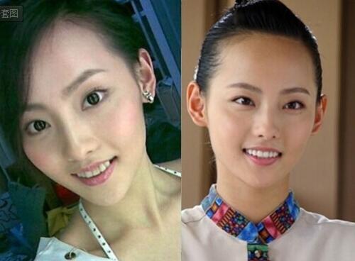 哪些明星整牙后像整容,明星整牙变美了