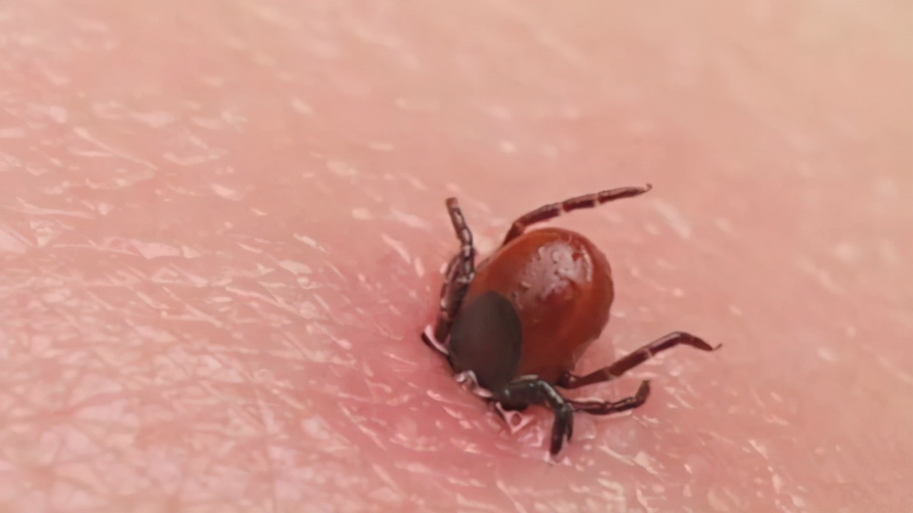 孩子被蜱虫幼虫咬了有事吗,小孩被蜱虫叮咬后怎么处理