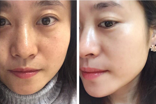 宝露斯补水产品,宝露斯护肤品好吗