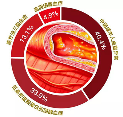 排名第一的降血脂运动,运动锻炼降低血脂最有效的方法