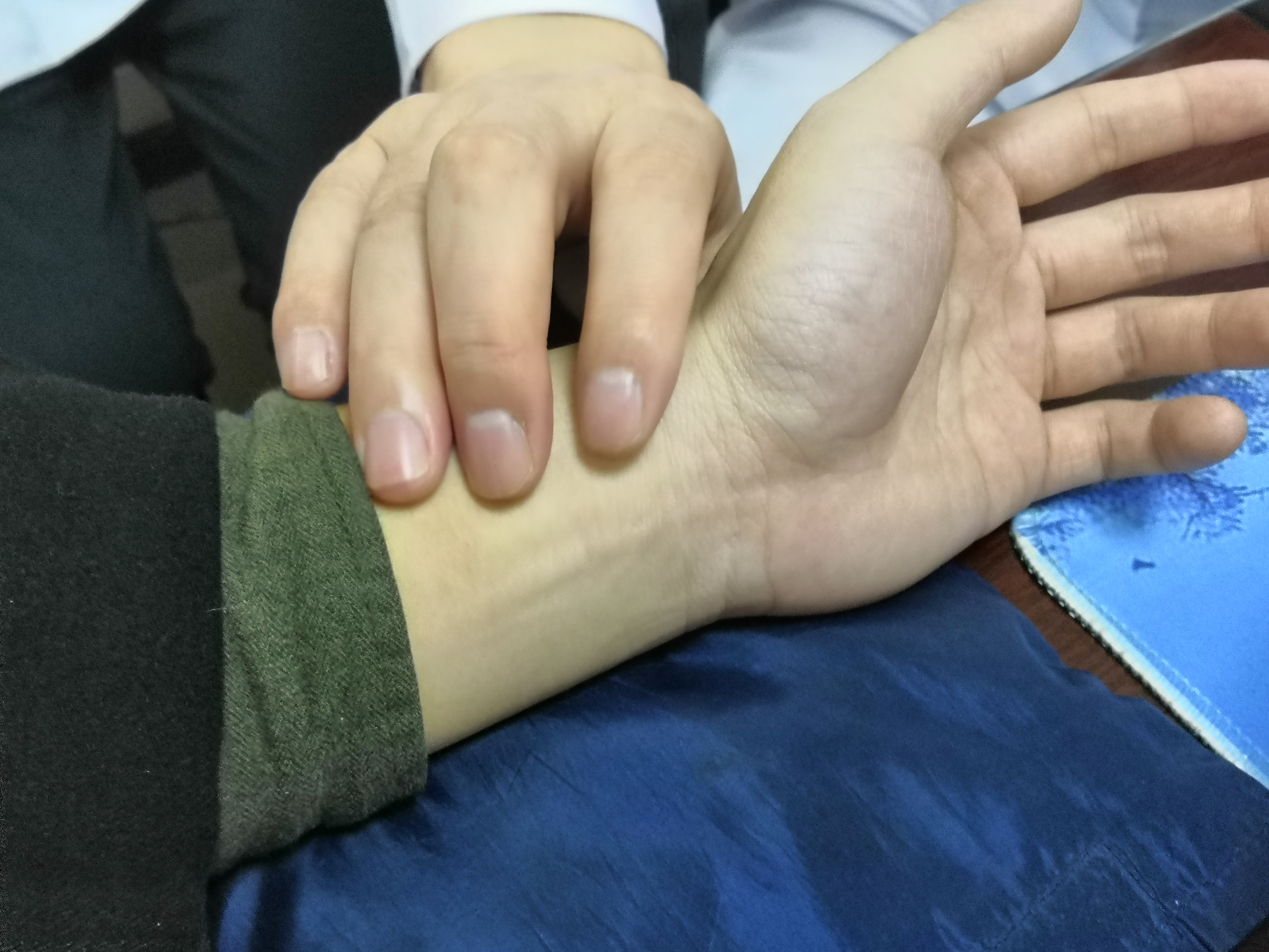 睾丸潮湿高温是前列腺炎引起的吗,夏天睾丸潮湿用什么药