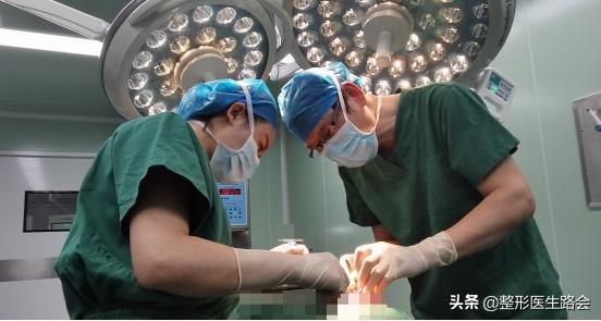 去除法令纹要先打苹果肌吗,去除法令纹可以打除皱针吗