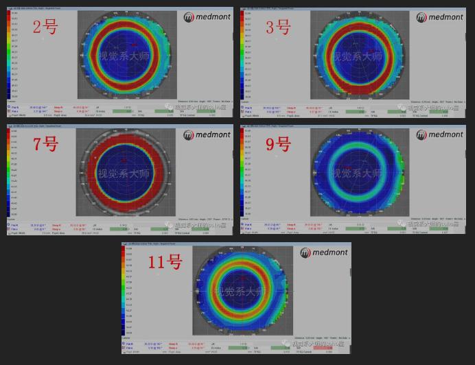 ok镜一周不戴近视更厉害吗,戴了ok镜真的可以恢复视力吗