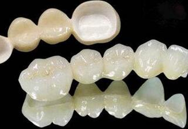 大连烤瓷牙和全瓷牙哪家好,大连烤瓷牙和全瓷牙哪个好