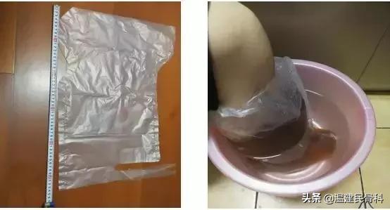 过年了,走亲戚脚疼怎么办?大脚骨患者注意了!