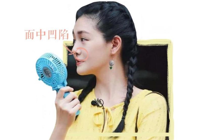 颧骨高导致脸型难看怎么办,脸型偏瘦颧骨明显怎么办改善