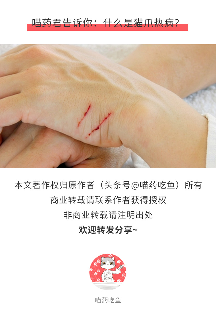 被猫咪抓伤用肥皂水洗可以吗,被家猫抓伤需要用肥皂水洗吗