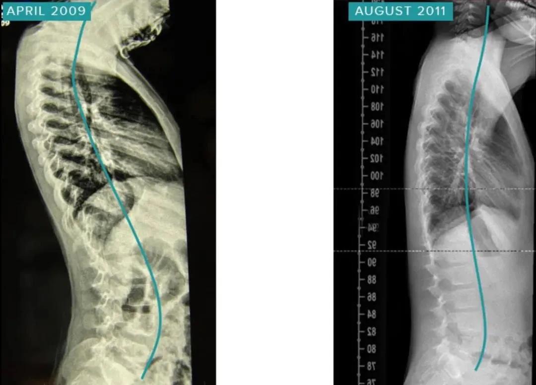 sps鍒涘浜虹悊鏌ュ痉,鐞嗘煡寰蜂翰鎺坰ps瀵煎笀