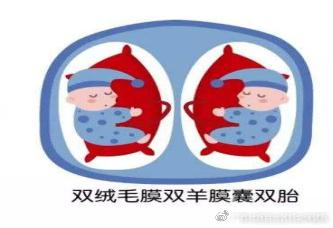 双胎妊娠分娩期并发症,双胎妊娠分娩注意事项