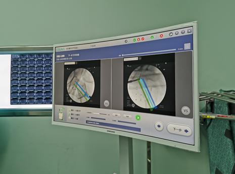 医生的“透视眼”、“稳定手”这位完美医助是咋工作的？