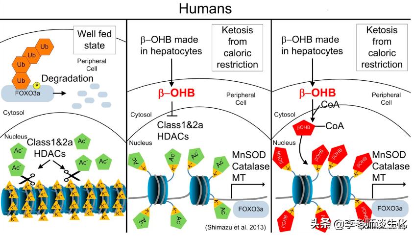 酮体的大体代谢过程,酮体的代谢有何特点和生理意义