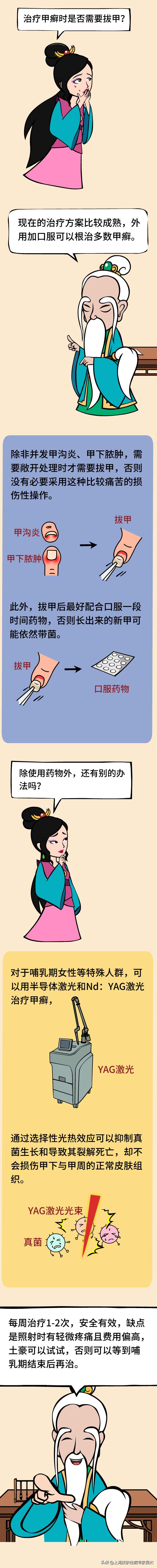 穿凉鞋有助于治疗灰指甲吗,穿凉鞋如何掩盖灰指甲