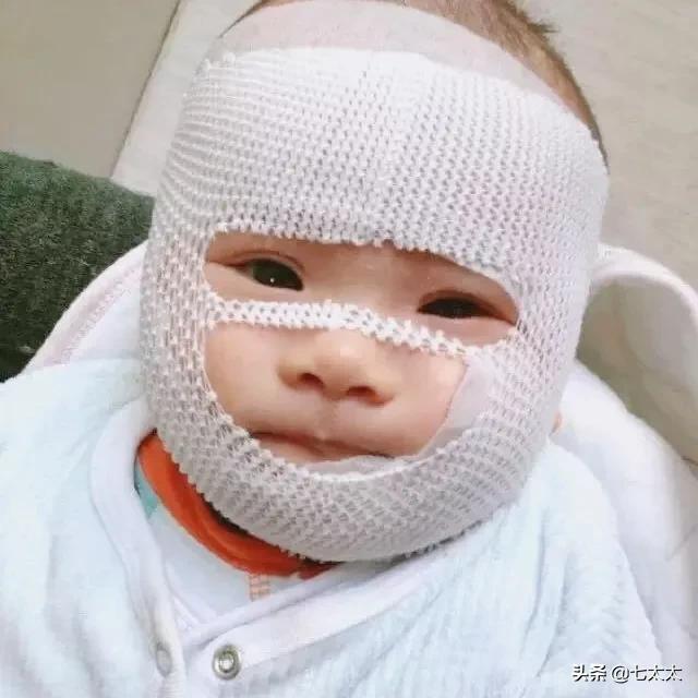 以「湿疹」之名的智商税,除了「大头娃娃」还有什么?