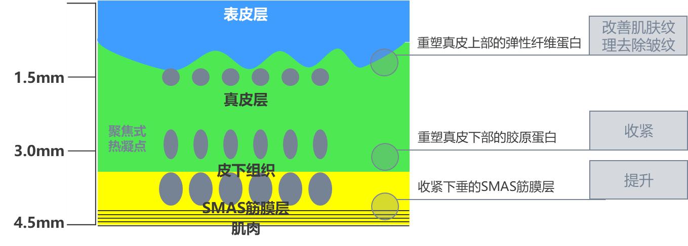 光电医美最新状况,光电仪器美容市场现状