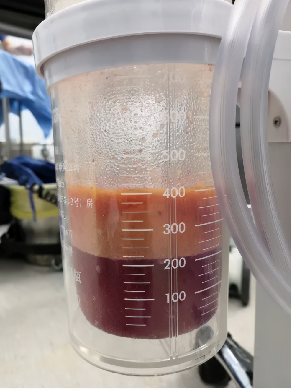 两个乳房发育不一致正常吗,乳房发育后才长腋毛正常吗