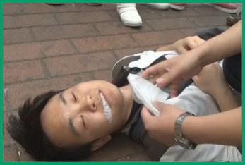 目前副作用最小的抗精神分裂症药,精神类药物副作用停药多久消失