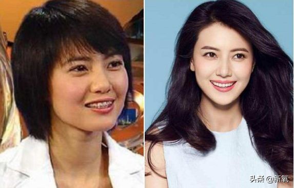 盘点整容后不敢认的女星颜值巅峰,知名女网红被扒整容