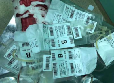 被剪刀刺的男孩怎么样了,被剪刀戳了3毫米深的伤口